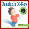Jessica's x-ray
