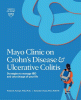 Mayo Clinic on Crohn's disease & ulcerative coliti...